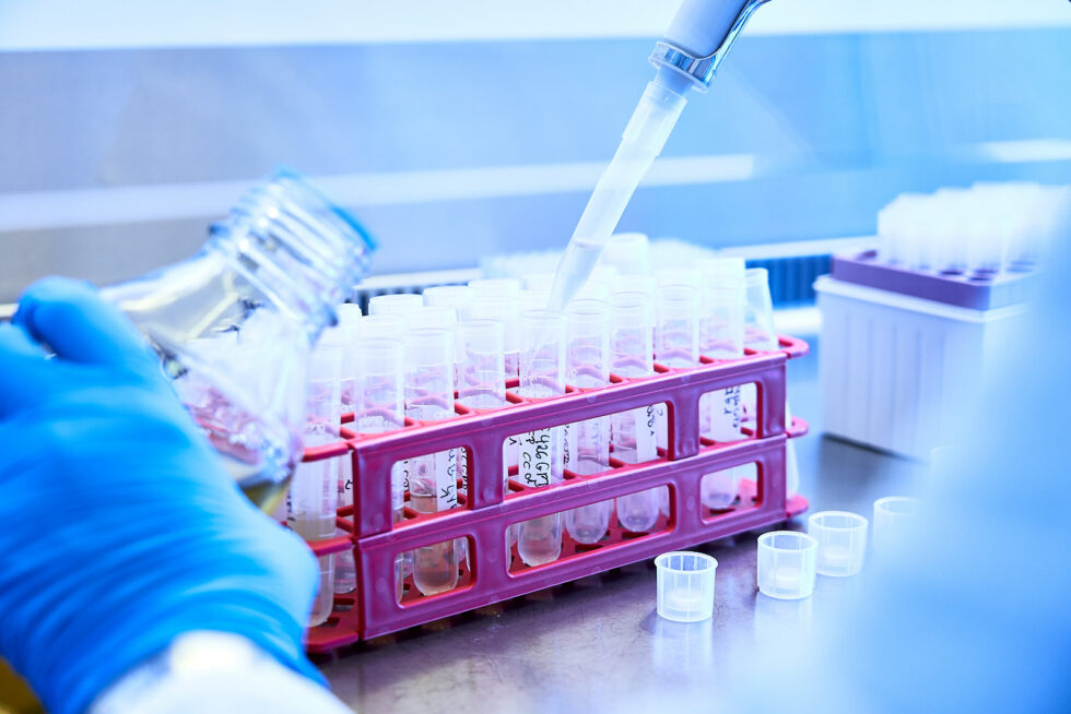 Hand beim pipettieren